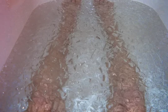 baños de hielo